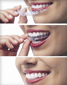 Invisalign can get you a smile that’s as straight as an arrow.