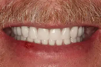 Smile Gallery