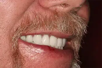 Smile Gallery