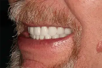 Smile Gallery