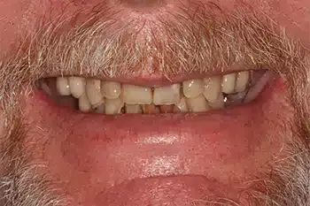 Smile Gallery