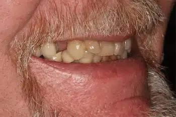Smile Gallery