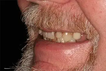 Smile Gallery