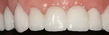 Smile Gallery