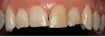 Smile Gallery