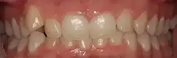 Smile Gallery