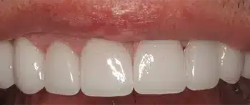 Smile Gallery