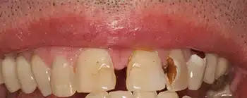 Smile Gallery