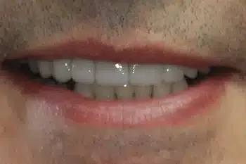 Smile Gallery