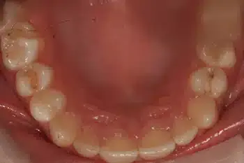 Smile Gallery