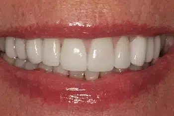 Smile Gallery
