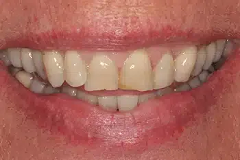 Smile Gallery