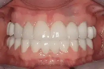 Smile Gallery