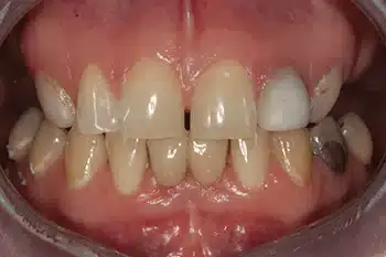 Smile Gallery