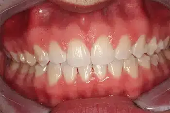 Smile Gallery