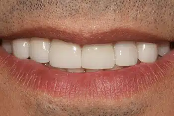 Smile Gallery