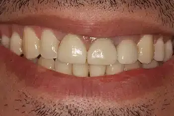 Smile Gallery