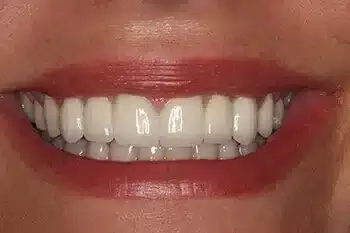 Smile Gallery